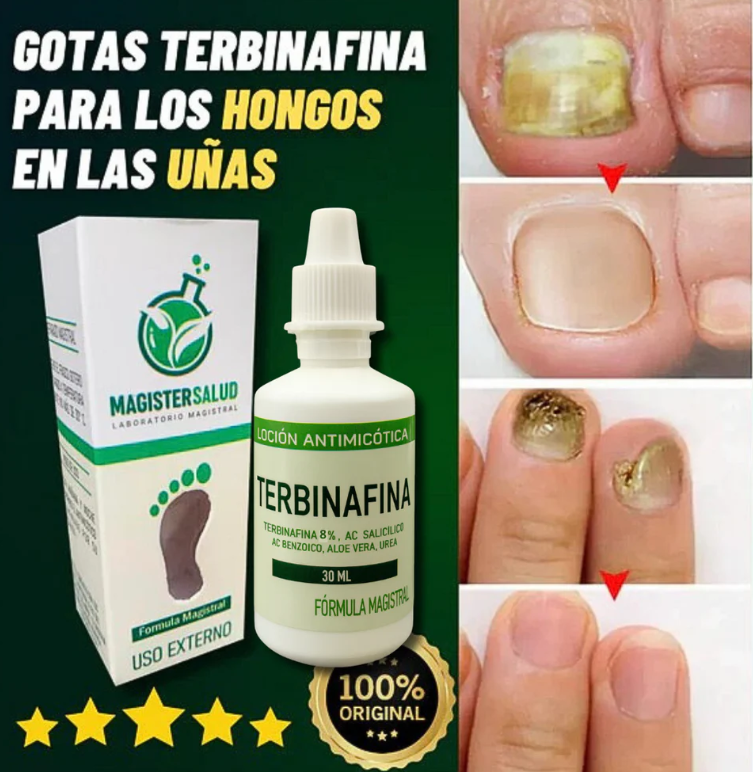 TERBINAFINA - LOCIÓN ANTIMICÓTICA