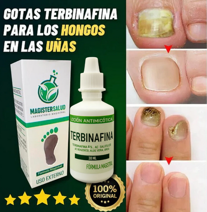 TERBINAFINA - LOCIÓN ANTIMICÓTICA